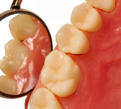 چرا لثه هنگام مسواک یا نخ دندان کشیدن، خونریزی میکند