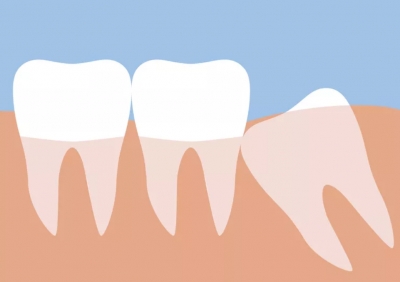 علل وجود دندان عقل چیست؟