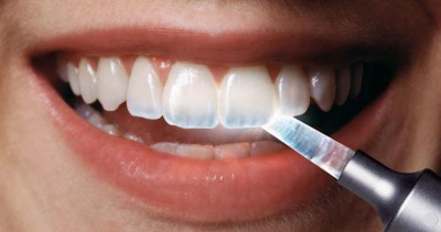 آنچه باید در مورد فرسایش دندان بدانیم