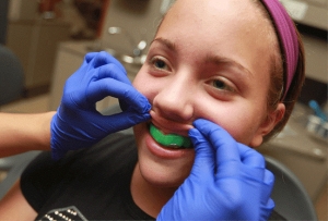 محافظ دندان و کاربرد انواع گارد دهان در دندانپزشکی