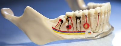از کجا بدانیم نیاز به عصب کشی دندان داریم؟