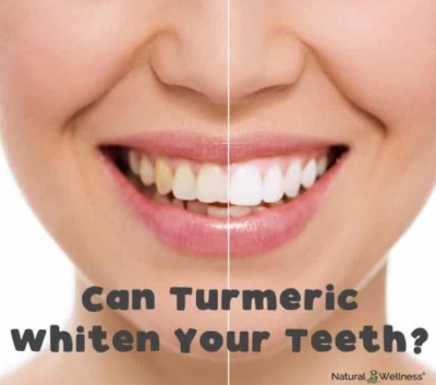 آیا می توانید از زردچوبه برای سفید کردن دندان استفاده کنید؟
