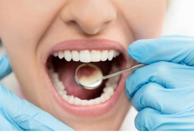 آیا روش های طبیعی برای جلوگیری از حفره دندان وجود دارد؟