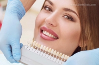 روش ساخت و جاگذاری لمینت دندان و مراقب های لازم