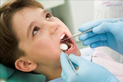 عادت های بد کودکان د ررابطه با سلامت دهان و دندان و جلوگیری از آن ها