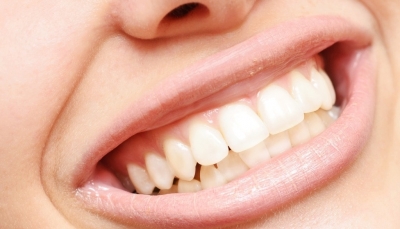 11 راه برای سالم نگه داشتن دندان ها