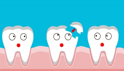 علل خورد شدن دندان و درمان آن