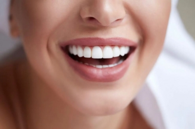 قبل از روکش دندان چه چیزهایی باید بدانید؟