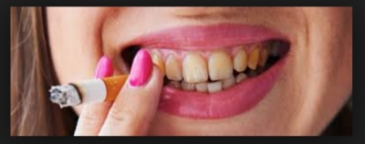 اثر سیگار کشیدن بر روی دندان ها