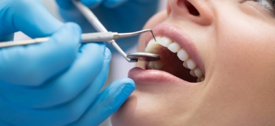 خدمات رایج در دندانپزشکی