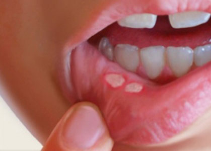 بخش تخصصی تشخیص و بیماری های دهان