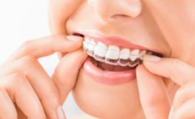 آیا راهی برای صاف کردن دندان ها بدون ارتودنسی وجود دارد؟