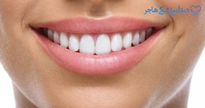 کلینیک تخصصی جرمگیری دندان | مرکز تهران