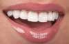 روشهای سفید کردن دندان