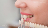 آيا لمنیت به دندان ها آسیب می زند؟
