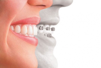 مزایای ارتودنسی دندان ها چیست ؟
